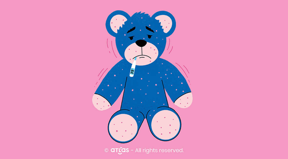 Chickenpox | Symptomatology, clinical forms and treatment